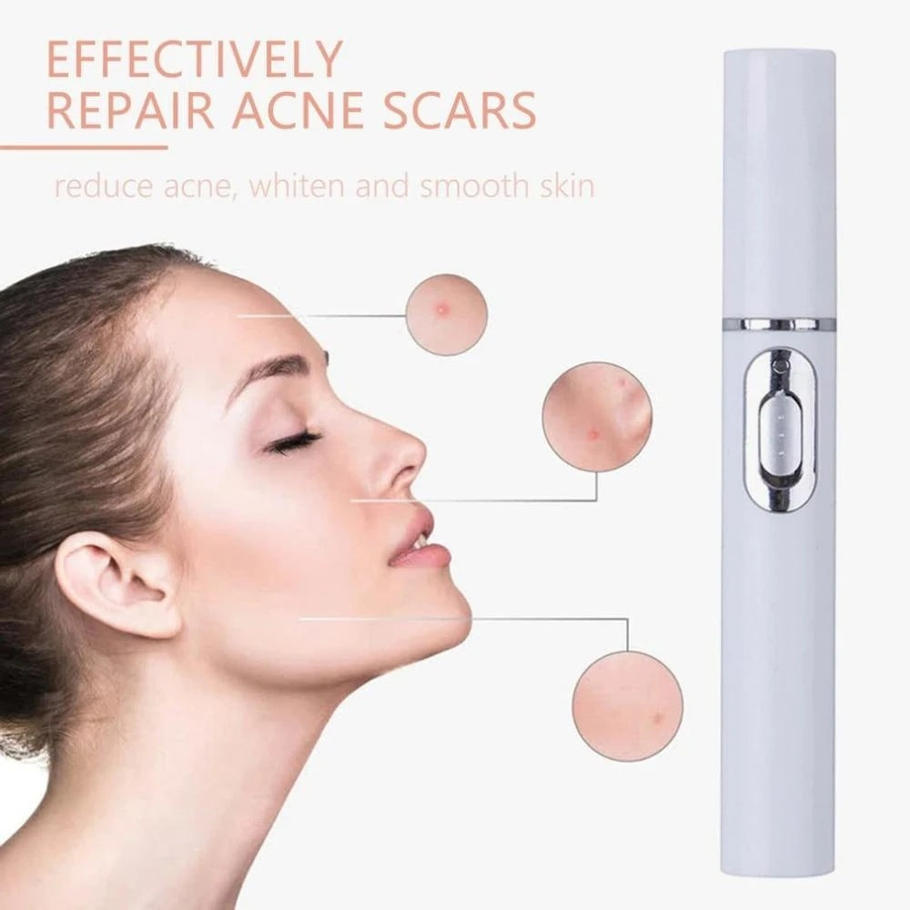 SelvEssence™ Blue-light Therapy Acne Laser Pen