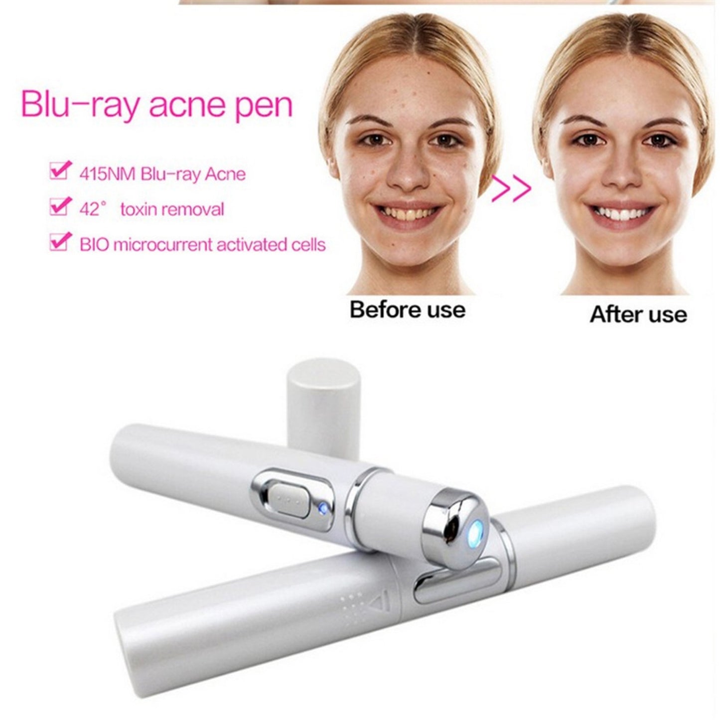 SelvEssence™ Blue-light Therapy Acne Laser Pen