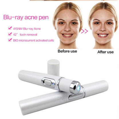 SelvEssence™ Blue-light Therapy Acne Laser Pen