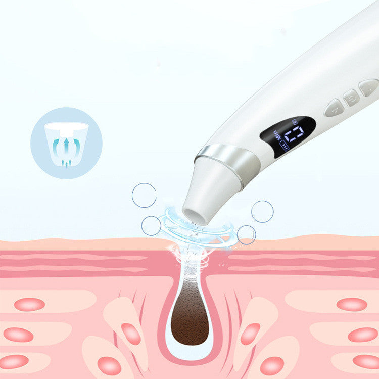 SelvEssence™ Visual Blackhead Remover