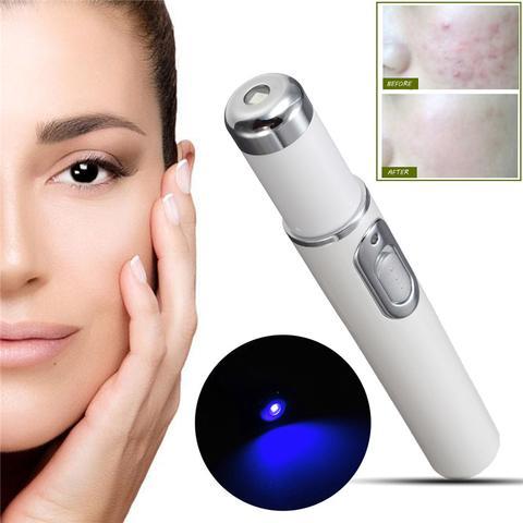 SelvEssence™ Blue-light Therapy Acne Laser Pen