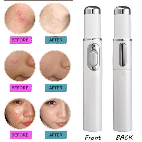 SelvEssence™ Blue-light Therapy Acne Laser Pen