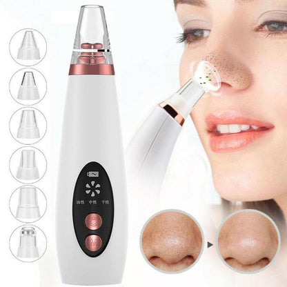 SelvEssence™ Blackhead Remover Vacuum